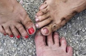 Causes of the infection